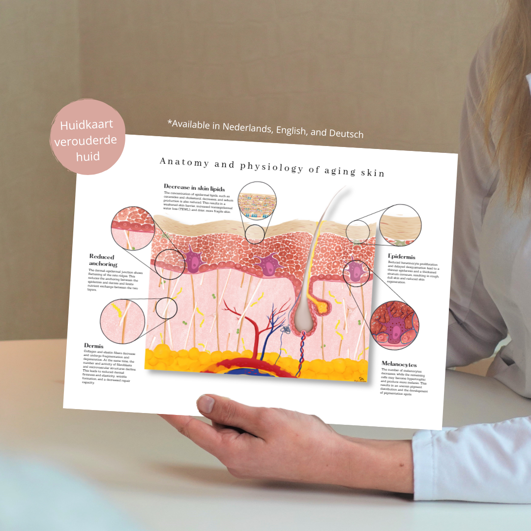 Acne skin map: detailed anatomical pathophysiology - educational tool